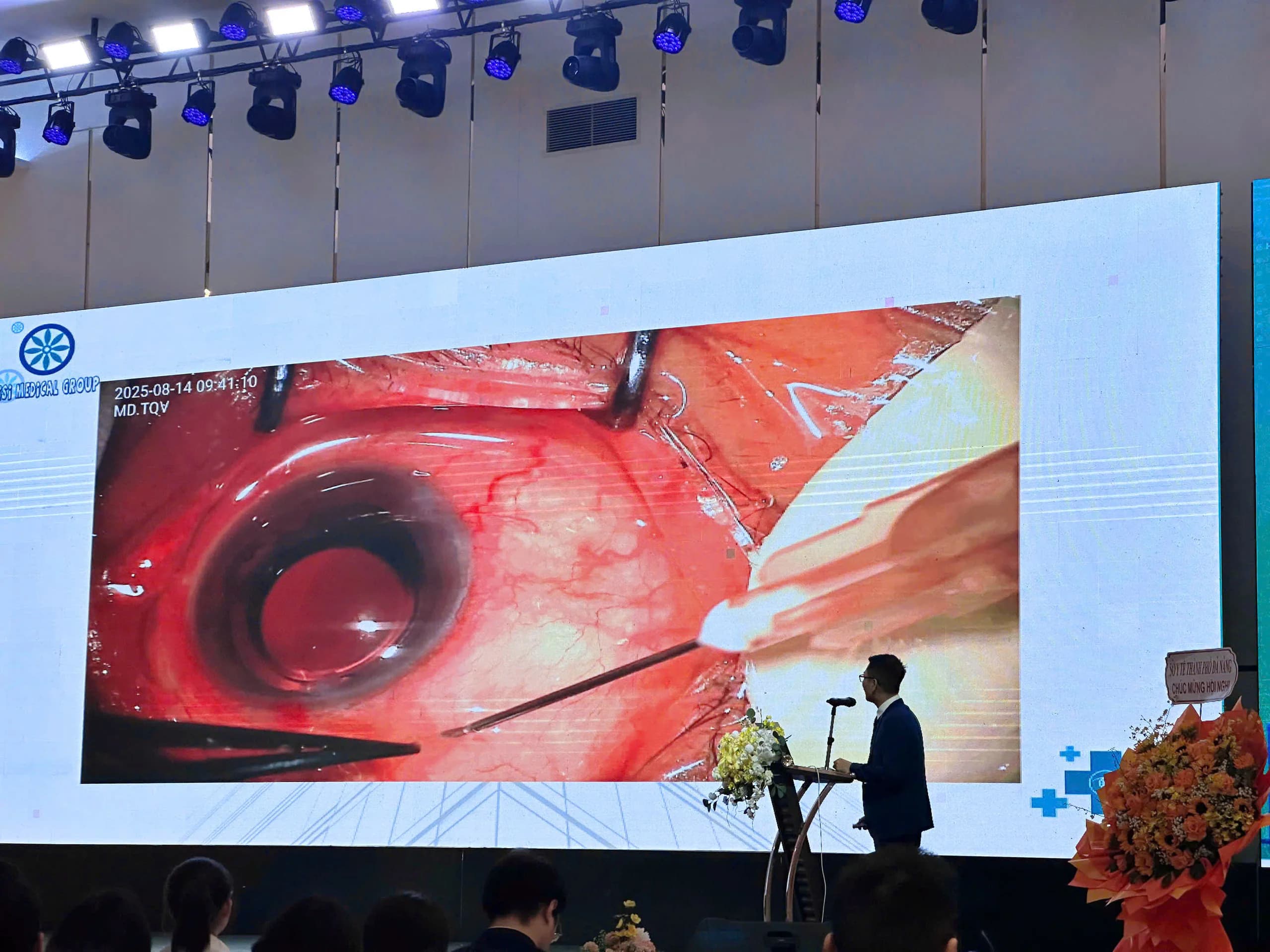 CHUYÊN GIA NHÃN KHOA CỦA TẬP ĐOÀN Y KHOA VISI BÁO CÁO TẠI HỘI THẢO GLÔCÔM 2026: KHẲNG ĐỊNH NỀN TẢNG CHUYÊN MÔN TRONG ĐIỀU TRỊ GLÔCÔM PHỨC TẠP.